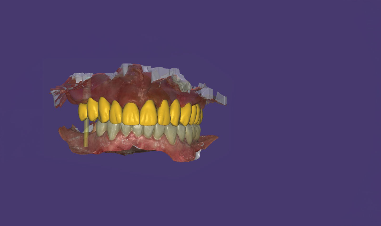 Zahntechnik AC Dental Design