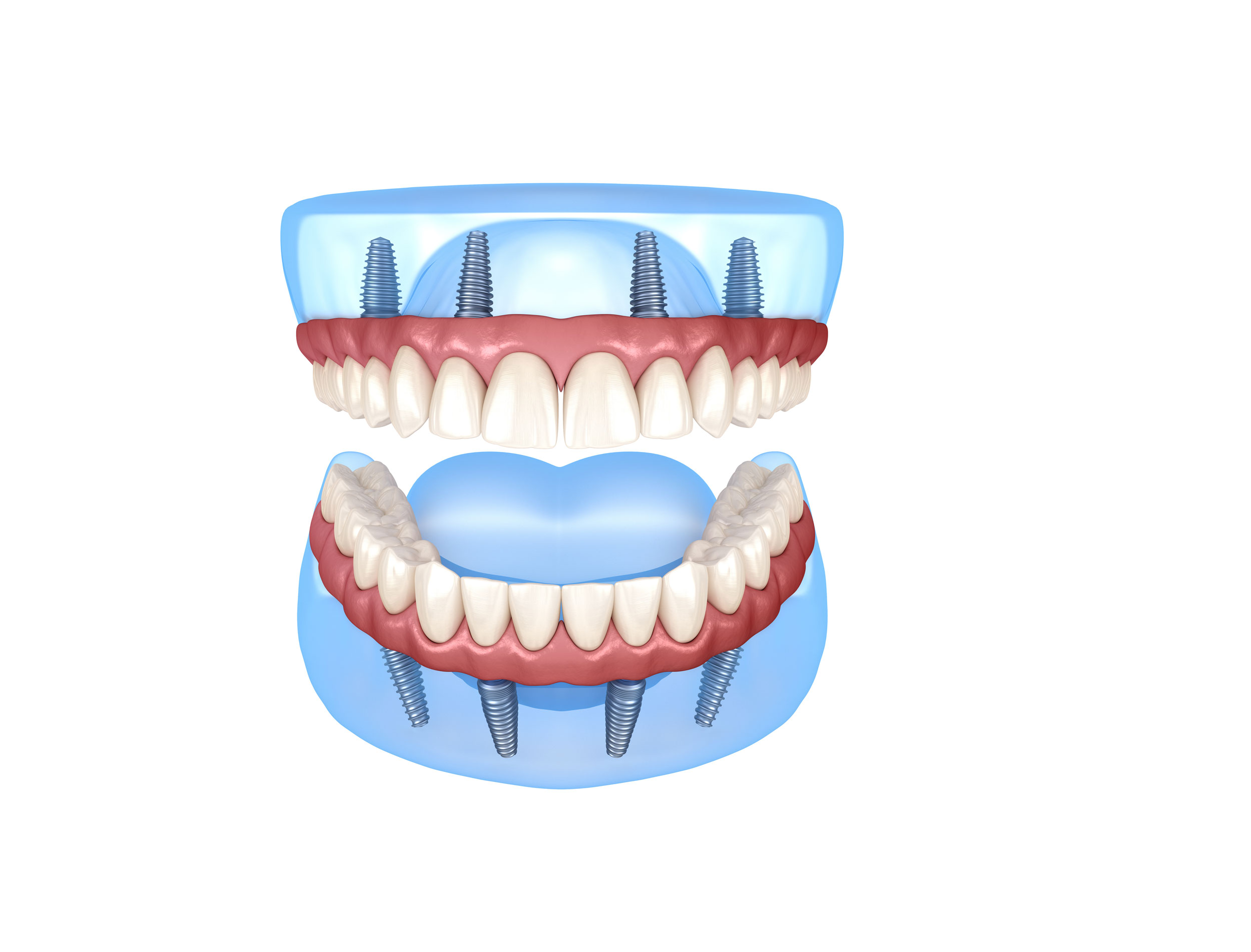 Zahntechnik AC Dental Design